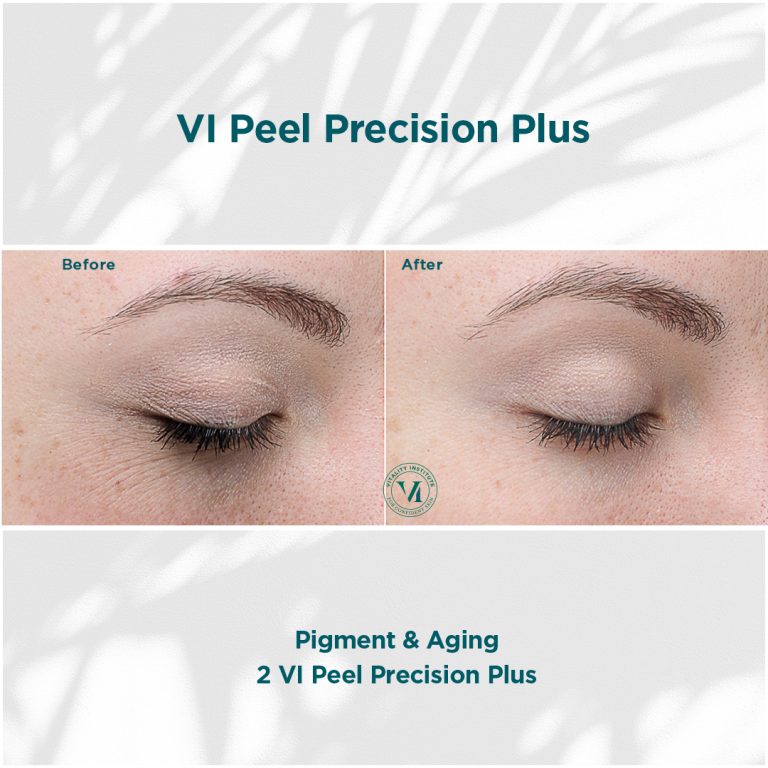 Pigment _ Aging_01