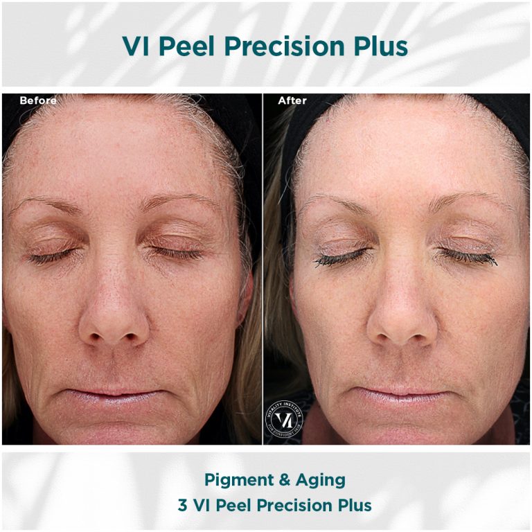 Pigment _ Aging_02